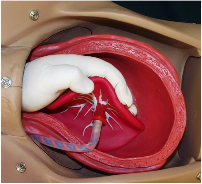 deliver-the-placenta-obgyn-morning-rounds